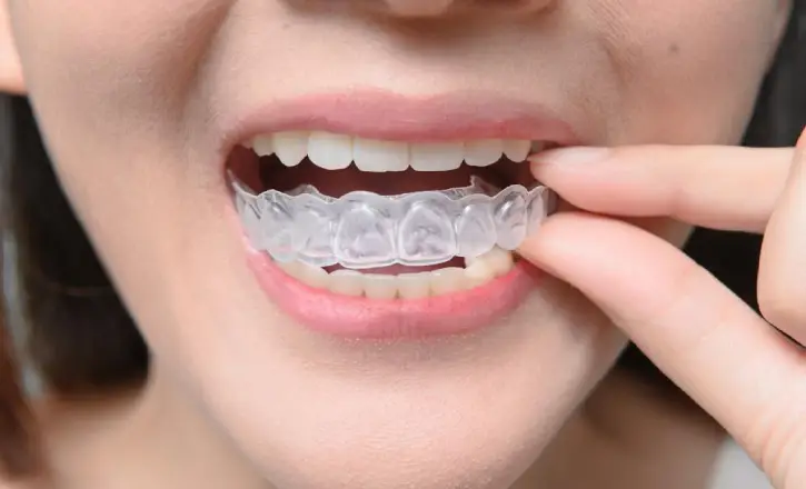 Facts You Didn't Know About Invisalign
