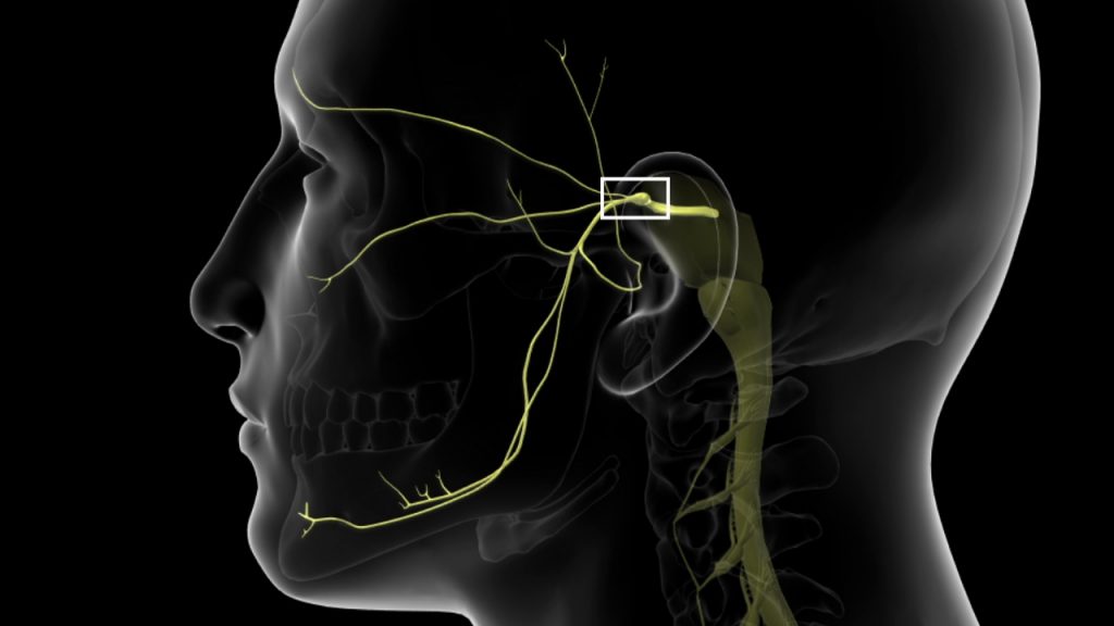 What All You Need to Know About Trigeminal Neuralgia?